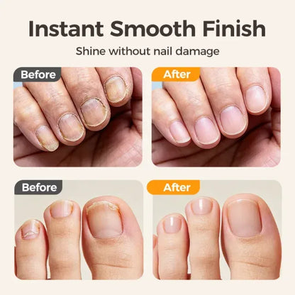 Telaion 2-in-1 Electric Nail Trimmer & Polisher with LED Light